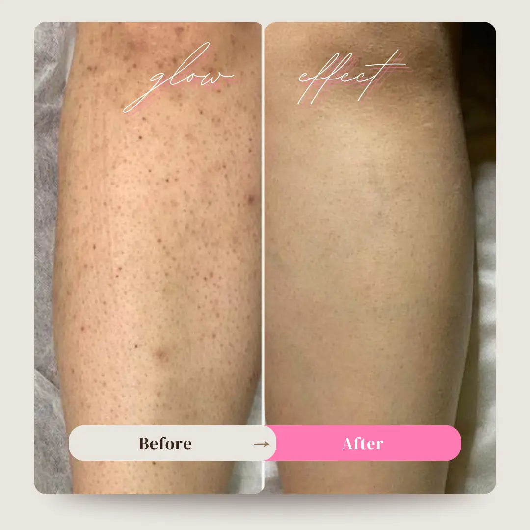 Glow razor, One-Pass Hair Remover™