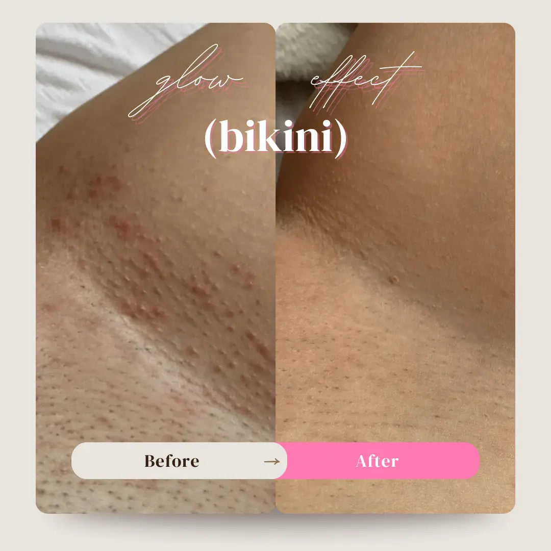 Glow & Glide, One-Pass Hair Remover™