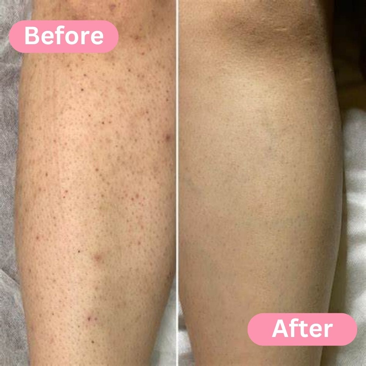 Before and After